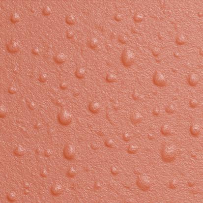 Acne Skin